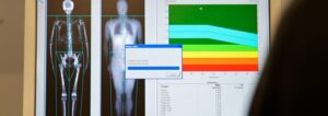 Medical scan image showing detailed bone and muscle composition analysis.